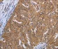 Anti-SHBG antibody produced in rabbit affinity isolated antibody