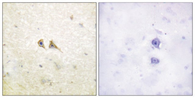 Anti-FAS LIGAND antibody produced in rabbit affinity isolated antibody