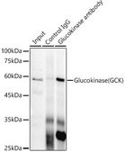 Anti-Glucokinase (GCK) Antibody, clone 4K9D5, Rabbit Monoclonal