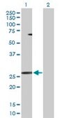 Anti-PPP3R1 antibody produced in rabbit purified immunoglobulin, buffered aqueous solution