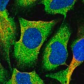 Anti-MVD antibody produced in rabbit Prestige Antibodies&#174; Powered by Atlas Antibodies, affinity isolated antibody, buffered aqueous glycerol solution