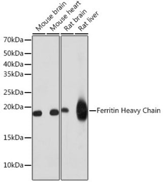 Anti-Ferritin Heavy Chain Antibody, clone 1Q10I7, Rabbit Monoclonal