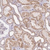 Anti-SERP1 antibody produced in rabbit Prestige Antibodies® Powered by Atlas Antibodies, affinity isolated antibody, buffered aqueous glycerol solution