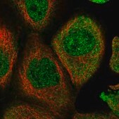 Anti-C9orf116 antibody produced in rabbit Prestige Antibodies&#174; Powered by Atlas Antibodies, affinity isolated antibody, buffered aqueous glycerol solution