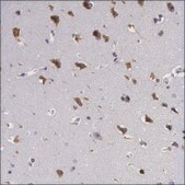 Anti-IL23A antibody produced in rabbit Prestige Antibodies® Powered by Atlas Antibodies, affinity isolated antibody, buffered aqueous glycerol solution