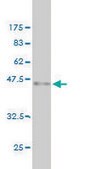 Monoclonal Anti-FTL antibody produced in mouse clone X3, purified immunoglobulin, buffered aqueous solution