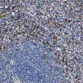 Anti-FGL2 antibody produced in rabbit Prestige Antibodies&#174; Powered by Atlas Antibodies, affinity isolated antibody, buffered aqueous glycerol solution, Ab1