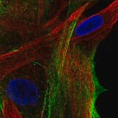Anti-ARSJ antibody produced in rabbit Prestige Antibodies&#174; Powered by Atlas Antibodies, affinity isolated antibody, buffered aqueous glycerol solution