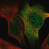 Anti-AP5S1 antibody produced in rabbit Prestige Antibodies&#174; Powered by Atlas Antibodies, affinity isolated antibody, buffered aqueous glycerol solution