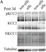 Anti-K+/Cl- Cotransporter (KCC2) Antibody Upstate®, from rabbit