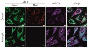 BioTracker™ Far Red Mitochondrial Superoxide Live Cell Probe