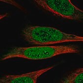 Anti-DEAF1 antibody produced in rabbit Prestige Antibodies&#174; Powered by Atlas Antibodies, affinity isolated antibody, buffered aqueous glycerol solution