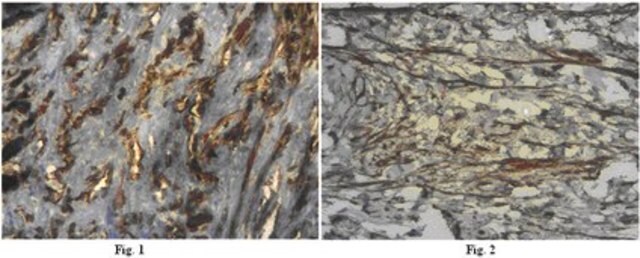 Anti-Integrin beta-3 Antibody from rabbit, purified by affinity chromatography