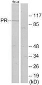 Anti-Progesterone Receptor antibody produced in rabbit affinity isolated antibody