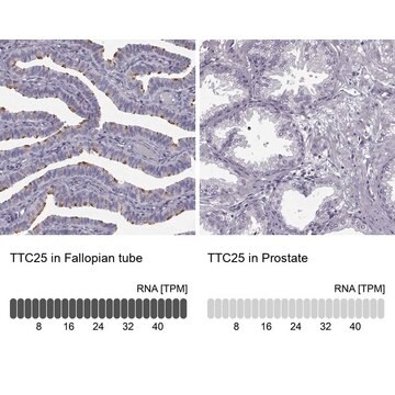 Anti-TTC25 antibody produced in rabbit Prestige Antibodies&#174; Powered by Atlas Antibodies, affinity isolated antibody, buffered aqueous glycerol solution, Ab2