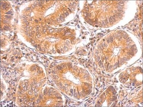 Anti-TTPA (C-terminal) antibody produced in rabbit affinity isolated antibody, buffered aqueous solution