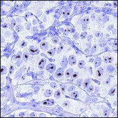 Anti-KDM5D antibody produced in rabbit Prestige Antibodies® Powered by Atlas Antibodies, affinity isolated antibody, buffered aqueous glycerol solution