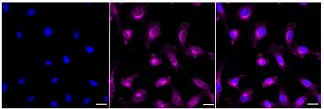 KD-Validated Anti Src Antibody, clone 23GB1110, Rabbit Monoclonal clone 23GB1110, recombinant rabbit monoclonal, expressed in HEK293 cells