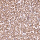Anti-ZNF584 antibody produced in rabbit Prestige Antibodies® Powered by Atlas Antibodies, affinity isolated antibody, buffered aqueous glycerol solution