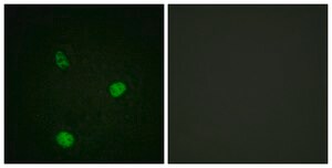 Anti-MITF antibody produced in rabbit affinity isolated antibody