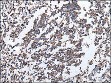 Anti-ENPP2 affinity isolated antibody