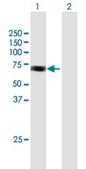 Anti-ACAD9 antibody produced in mouse IgG fraction of antiserum, buffered aqueous solution