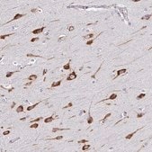 Anti-LARS antibody produced in rabbit Prestige Antibodies® Powered by Atlas Antibodies, affinity isolated antibody, buffered aqueous glycerol solution