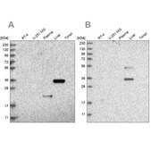 抗-RGN 兔抗 Prestige Antibodies&#174; Powered by Atlas Antibodies, affinity isolated antibody, buffered aqueous glycerol solution, ab2