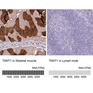 Anti-TNNT1 antibody produced in rabbit Prestige Antibodies&#174; Powered by Atlas Antibodies, affinity isolated antibody, buffered aqueous glycerol solution