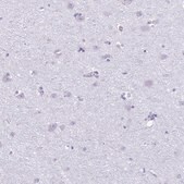 Anti-PRM2 antibody produced in rabbit Prestige Antibodies&#174; Powered by Atlas Antibodies, affinity isolated antibody, buffered aqueous glycerol solution