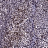 Anti-BACH2 antibody produced in rabbit Prestige Antibodies&#174; Powered by Atlas Antibodies, affinity isolated antibody, buffered aqueous glycerol solution