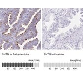 Anti-SNTN antibody produced in rabbit Prestige Antibodies® Powered by Atlas Antibodies, affinity isolated antibody, buffered aqueous glycerol solution