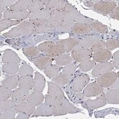 Anti-ARHGAP45 antibody produced in rabbit Prestige Antibodies® Powered by Atlas Antibodies, affinity isolated antibody, buffered aqueous glycerol solution