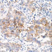 Anti-EGFR (L858R) Antibody, clone 1J5C6, Rabbit Monoclonal