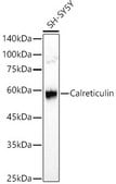 Anti-Calreticulin Antibody, clone 7T5B2, Rabbit Monoclonal