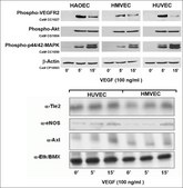 Human Dermal Microvascular Endothelial Cells: CADMEC/HMVEC: Pre-Screened for Angiogenesis &amp; VEGF signaling, adult