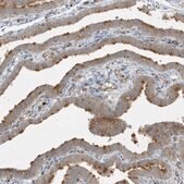 Anti-IFT57 antibody produced in rabbit Prestige Antibodies&#174; Powered by Atlas Antibodies, affinity isolated antibody, buffered aqueous glycerol solution