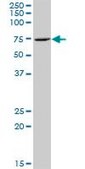 Anti-ZNF257 antibody produced in mouse purified immunoglobulin, buffered aqueous solution