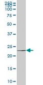 Monoclonal Anti-HSPC111 antibody produced in mouse clone 1G4, purified immunoglobulin, buffered aqueous solution