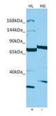 Anti-IQSEC2 antibody produced in rabbit affinity isolated antibody