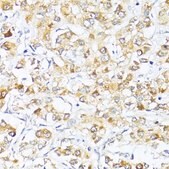 Anti-EIF2S1 antibody produced in rabbit