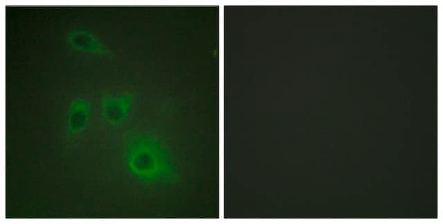 Anti-HSP90B antibody produced in rabbit affinity isolated antibody