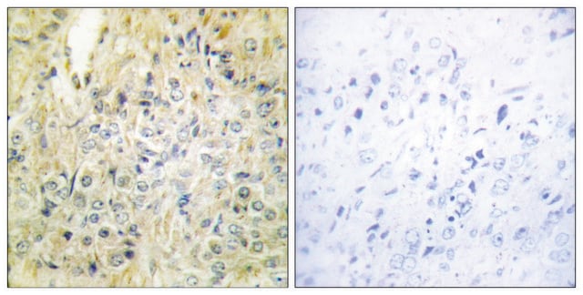 Anti-DLEC1 antibody produced in rabbit affinity isolated antibody