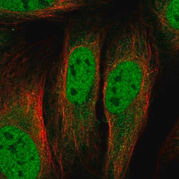 Anti-Kat5 Antibody Produced In Rabbit Prestige Antibodies&#174; Powered by Atlas Antibodies, affinity isolated antibody, buffered aqueous glycerol solution