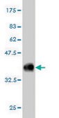 Monoclonal Anti-CABC1 antibody produced in mouse clone 5A4, ascites fluid, solution