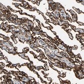 Anti-SUSD2 antibody produced in rabbit Prestige Antibodies&#174; Powered by Atlas Antibodies, affinity isolated antibody, buffered aqueous glycerol solution