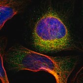 Anti-TMEM125 antibody produced in rabbit Prestige Antibodies® Powered by Atlas Antibodies, affinity isolated antibody, buffered aqueous glycerol solution