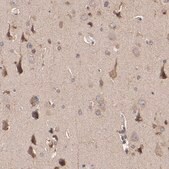 Anti-STON2 antibody produced in rabbit Prestige Antibodies&#174; Powered by Atlas Antibodies, affinity isolated antibody, buffered aqueous glycerol solution