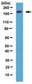抗-Telo I 型胶原蛋白，A1/COL1A1 from rabbit, purified by affinity chromatography