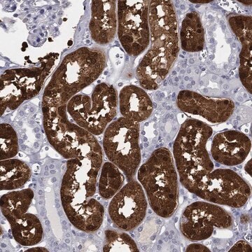 Anti-Aldob Antibody Produced In Rabbit Prestige Antibodies&#174; Powered by Atlas Antibodies, affinity isolated antibody, buffered aqueous glycerol solution